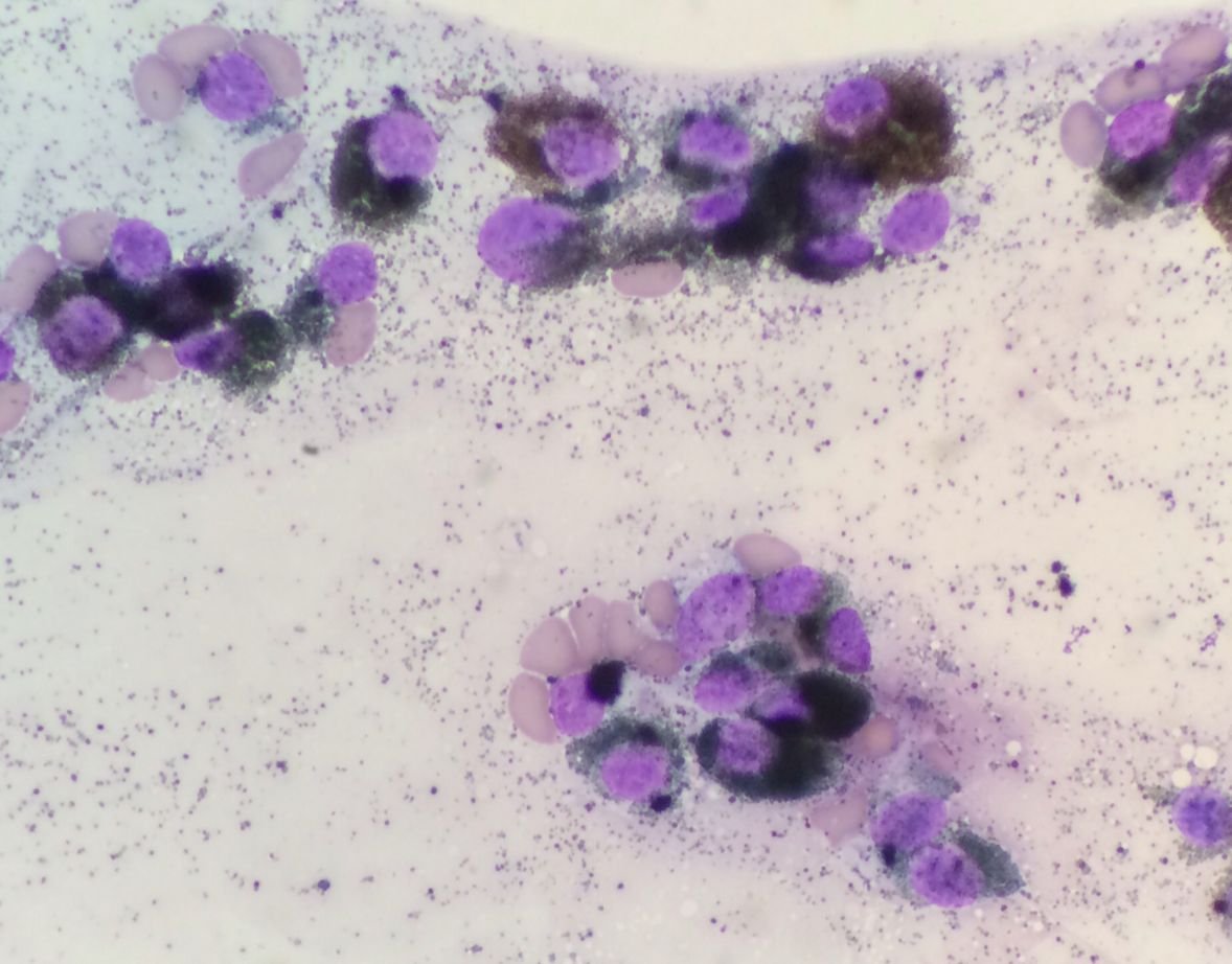 Imagen microscópica de células teñidas en tonos morado y rosado observadas en muestra biológica